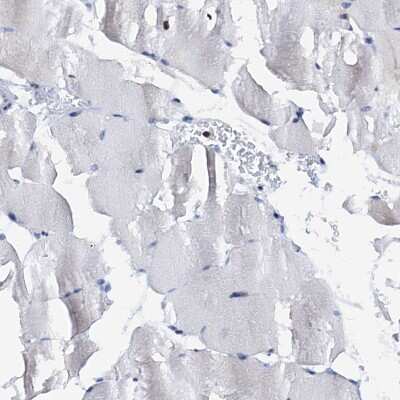 Immunohistochemistry-Paraffin: SLP-76/LCP2 Antibody [NBP1-87032]