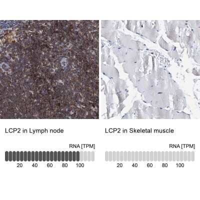 Immunohistochemistry-Paraffin: SLP-76/LCP2 Antibody [NBP1-87032]