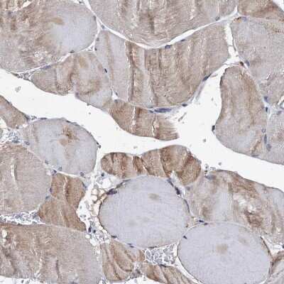 Immunohistochemistry-Paraffin: SLP-76/LCP2 Antibody [NBP1-87033]