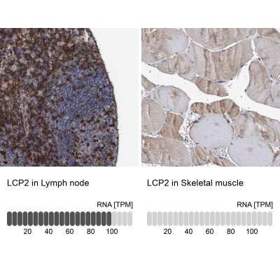 Immunohistochemistry-Paraffin: SLP-76/LCP2 Antibody [NBP1-87033]