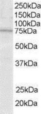 Western Blot: SLP-76/LCP2 Antibody [NB100-1439]