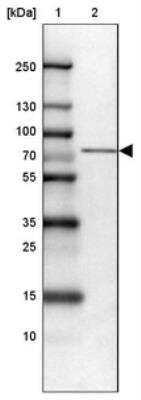 Western Blot: SLP-76/LCP2 Antibody [NBP1-87032]