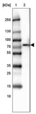 Western Blot: SLP-76/LCP2 Antibody [NBP1-87033]