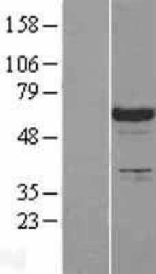 Western Blot: SLP-76/LCP2 Overexpression Lysate [NBL1-12467]