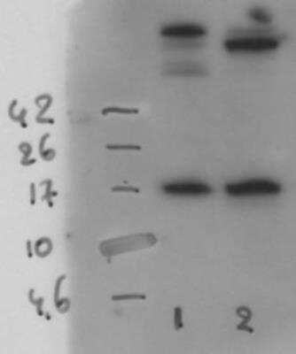 Western Blot: SLPI Antibody (31) [NBP1-42437]