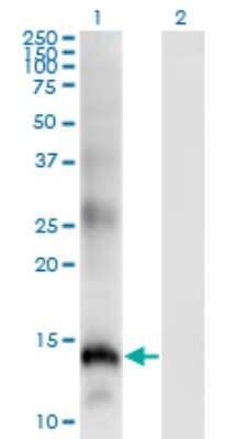 Western Blot: SLPI Antibody (3C6) [H00006590-M01]