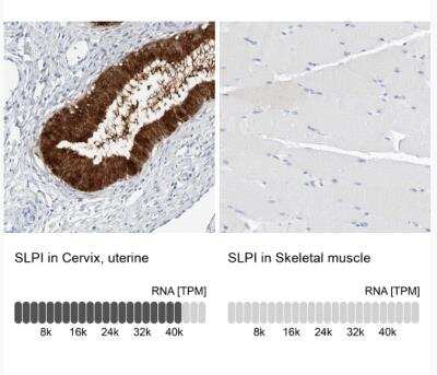 Immunohistochemistry-Paraffin: SLPI Antibody [NBP1-89139]