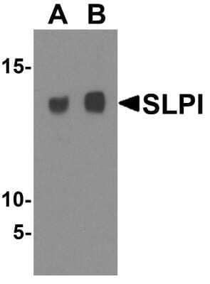 Western Blot: SLPI AntibodyBSA Free [NBP1-76396]