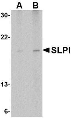 Western Blot: SLPI AntibodyBSA Free [NBP1-76803]