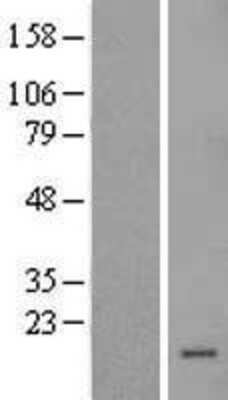 Western Blot: SLPI Overexpression Lysate [NBL1-16215]