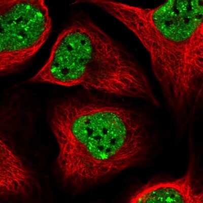 Immunocytochemistry/ Immunofluorescence: SLTM Antibody [NBP2-38464]