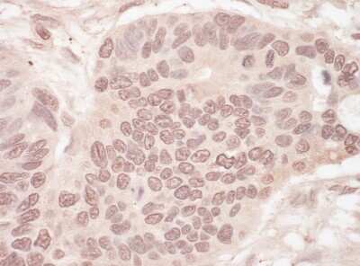 Immunohistochemistry: SLTM Antibody [NBP1-47299]