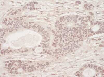 Immunohistochemistry-Paraffin: SLTM Antibody [NBP1-47300]