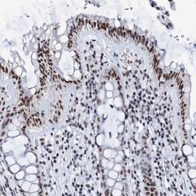 Immunohistochemistry-Paraffin: SLTM Antibody [NBP2-38464]