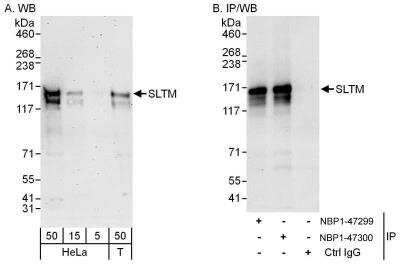 Western Blot: SLTM Antibody [NBP1-47300]