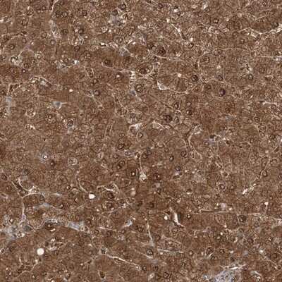 Immunohistochemistry-Paraffin: SLU7 Antibody [NBP1-89343]