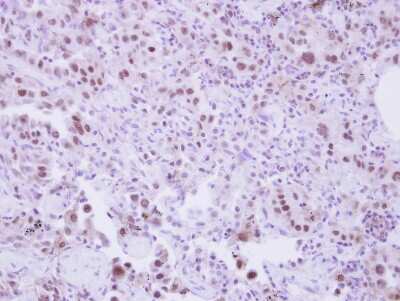 Immunohistochemistry-Paraffin: SLU7 Antibody [NBP2-20402]