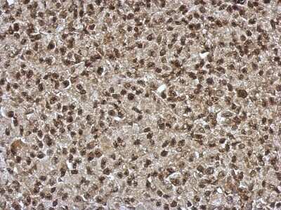 Immunohistochemistry-Paraffin: SLU7 Antibody [NBP2-20403]