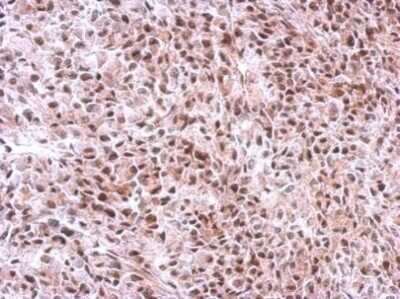 Immunohistochemistry-Paraffin: SLU7 Antibody [NBP2-42921]