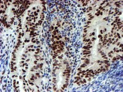 Immunohistochemistry-Paraffin: Slug Antibody (OTI1A6) [NBP2-03886]