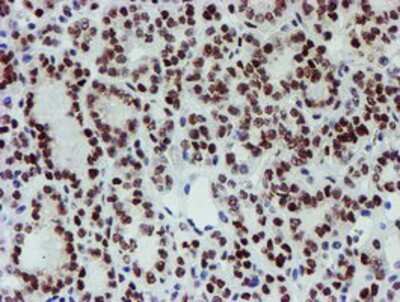 Immunohistochemistry-Paraffin: Slug Antibody (OTI1A6) [NBP2-03886]