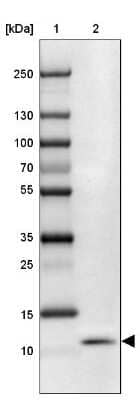 Western Blot: SLURP1 Antibody [NBP2-13351]