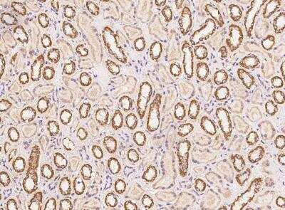 Immunohistochemistry-Paraffin: SLX1A Antibody [NBP3-06545]