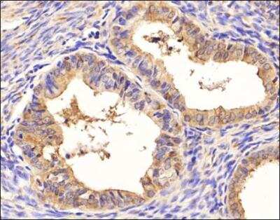 Immunohistochemistry: SM047 Antibody (SM047) [NBP1-97921]