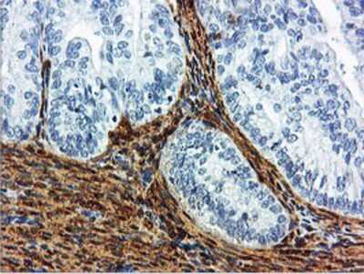 Immunohistochemistry-Paraffin: Transgelin/TAGLN/SM22 alpha Antibody (OTI8C8) [NBP2-00894]
