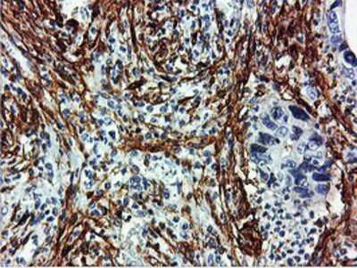 Immunohistochemistry-Paraffin: Transgelin/TAGLN/SM22 alpha Antibody (OTI8C8) [NBP2-00894]
