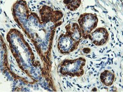 Immunohistochemistry-Paraffin: Transgelin/TAGLN/SM22 alpha Antibody (OTI8C8) [NBP2-00894]