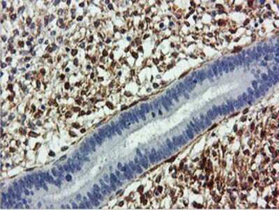 Immunohistochemistry-Paraffin: Transgelin/TAGLN/SM22 alpha Antibody (OTI8C8) [NBP2-00894]