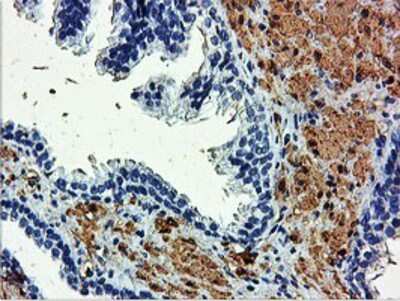 Immunohistochemistry-Paraffin: Transgelin/TAGLN/SM22 alpha Antibody (OTI8C8) [NBP2-00894]