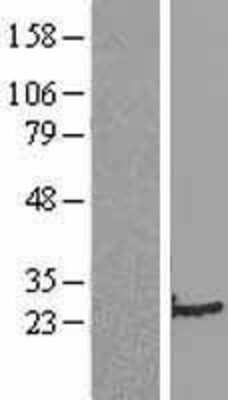 Western Blot: Transgelin/TAGLN/SM22 alpha Overexpression Lysate [NBL1-16691]