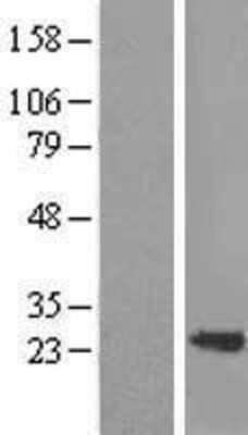 Western Blot: Transgelin/TAGLN/SM22 alpha Overexpression Lysate [NBL1-16692]