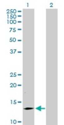 Western Blot: SMA4 Antibody [H00011039-B01P]