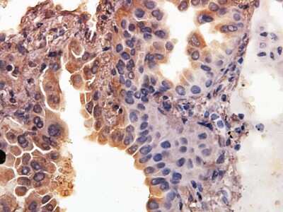 Immunohistochemistry-Paraffin: SMAC/Diablo Antibody [NB100-56165]