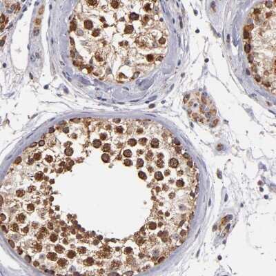 Immunohistochemistry-Paraffin: SMAC/Diablo Antibody [NBP1-84262]