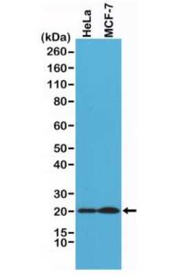 Western Blot: SMAC/Diablo Antibody (RM271) [NBP2-61586]