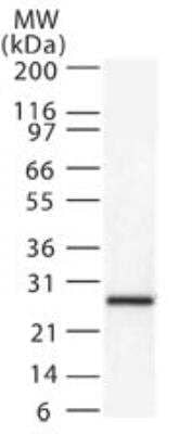 Western Blot: SMAC/Diablo Antibody [NB100-56311]