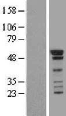 Western Blot: Smad1 Overexpression Lysate [NBL1-16219]