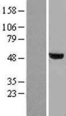 Western Blot: Smad2 Overexpression Lysate [NBL1-16220]