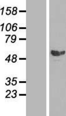 Western Blot: Smad2 Overexpression Lysate [NBL1-16221]