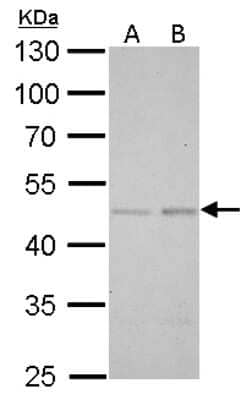 Western Blot: Smad5 Antibody [NBP2-20413]