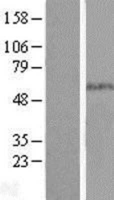 Western Blot: Smad5 Overexpression Lysate [NBL1-16225]