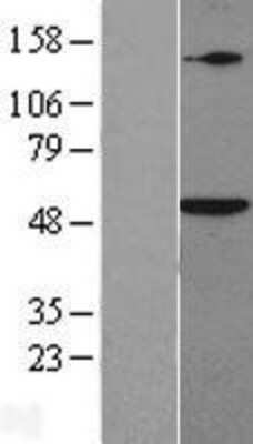 Western Blot: Smad5 Overexpression Lysate [NBP2-09079]