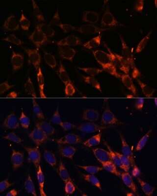 Immunocytochemistry/ Immunofluorescence: SMAD6 Antibody - BSA Free [NBP2-93787]