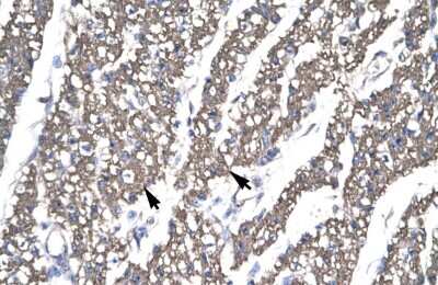 Immunohistochemistry: SMAD6 Antibody [NBP2-88312]