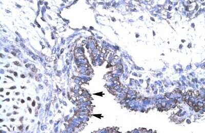 Immunohistochemistry: SMAD6 Antibody [NBP2-88312]