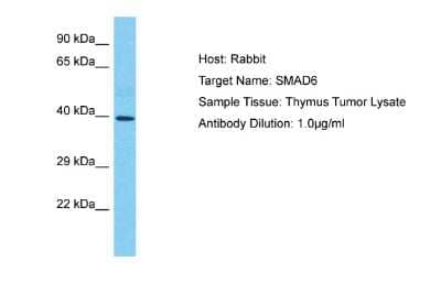 Western Blot: SMAD6 Antibody [NBP2-88310]